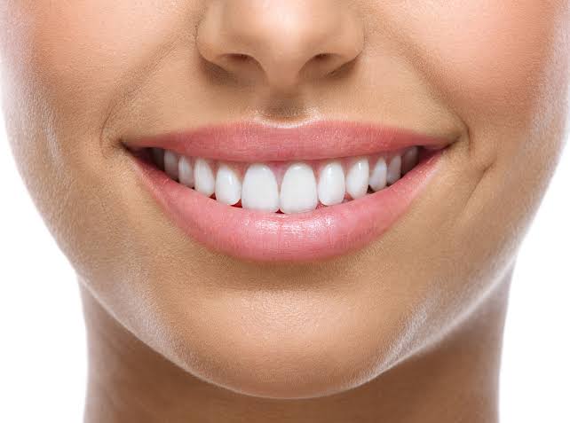 Professional teeth whitening benefits