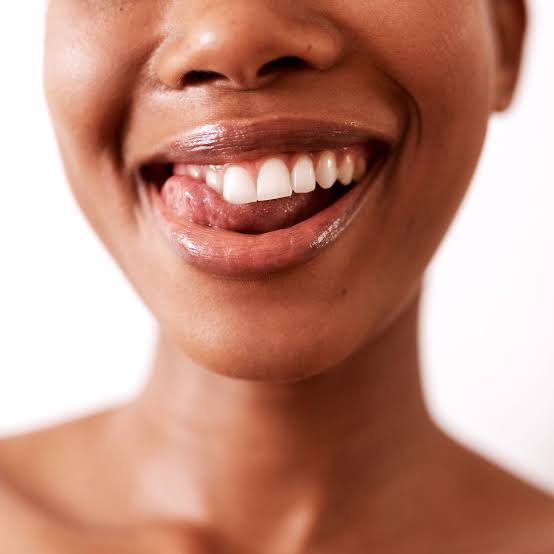 Teeth Whitening